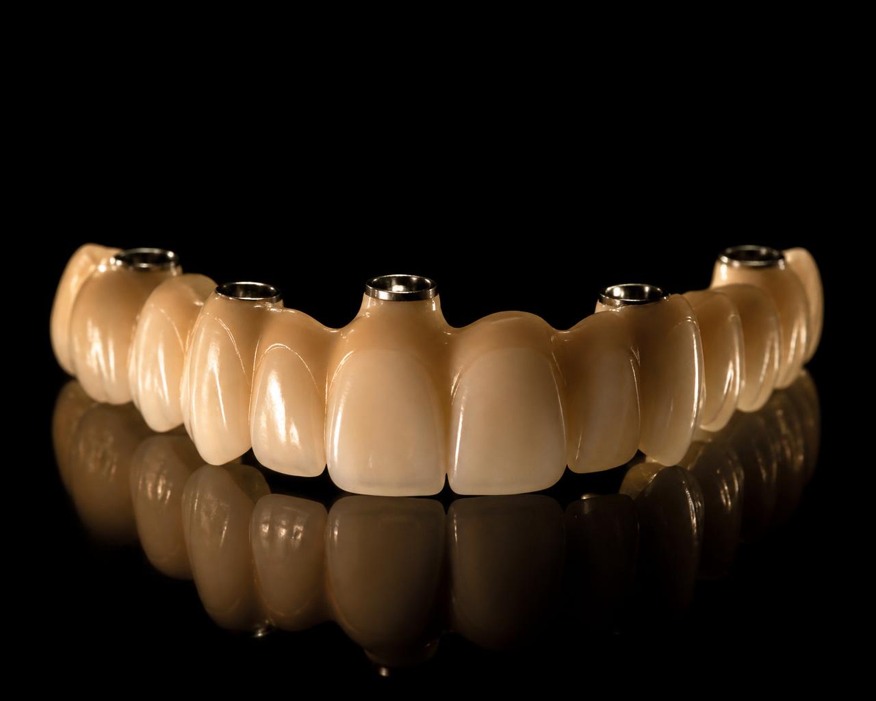 Prótese de cerâmica preparada para ser instalada sobre implantes